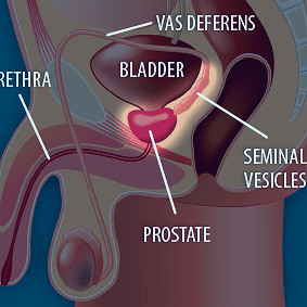 Tips for Keeping a Healthy Prostate | Johns Hopkins Medicine